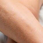 Why Your Skin Gets Dry in Autumn (And Why It Feels So Sudden)