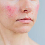 Sensitive Skin Guide: Simple Routine for Calm, Healthy Skin