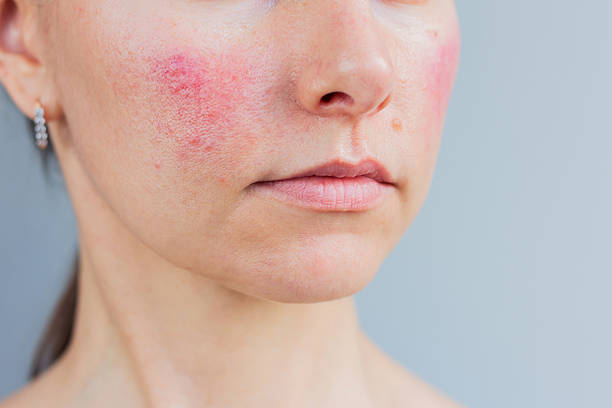 Sensitive Skin Guide: Simple Routine for Calm, Healthy Skin