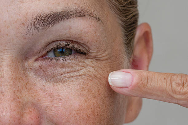 Fine Lines: Why They Appear So Early (And What You Can Actually Do About Them)
