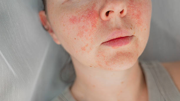 How to Repair Your Skin Barrier Before Winter (And Why Autumn Is the Perfect Time to Start)