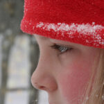 Redness During Cold Weather: Why It Happens