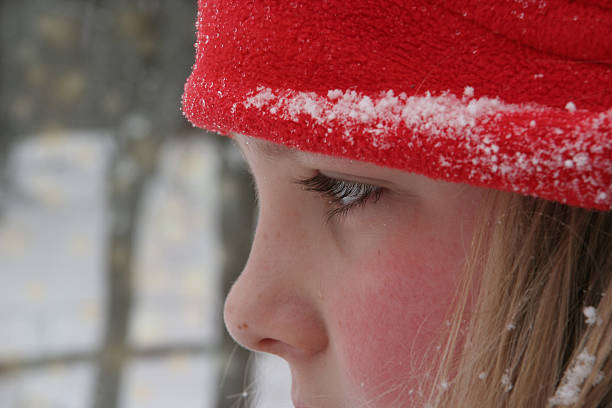 Redness During Cold Weather: Why It Happens