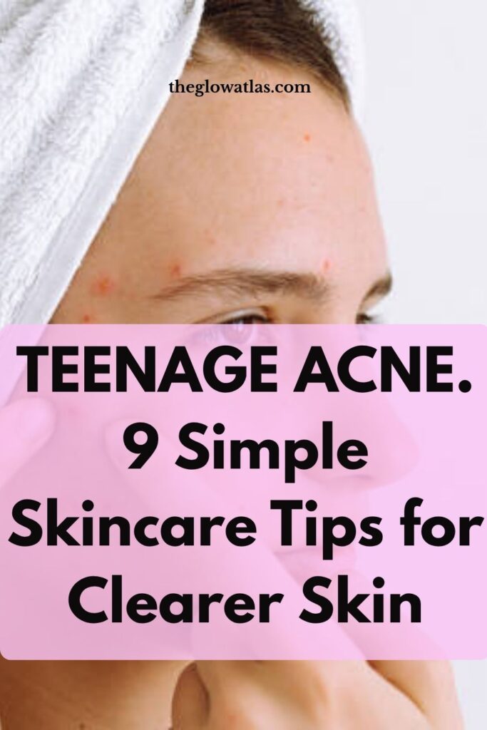 Teen acne causes, treatments and simple skincare routine