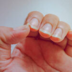 Close-up of a brittle fingernail with a split edge