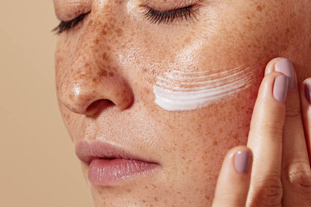 Woman applying moisturizer to freckled facial skin