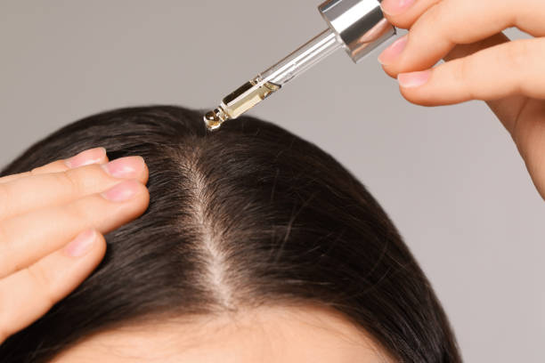 Woman applying hair oil to the scalp with a dropper
