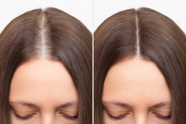 Four stages of the hair growth cycle and shedding guide